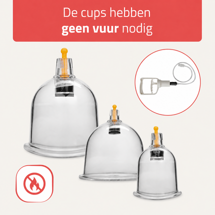 HABYS Cuppingset - 24 delig - met cuppingbekers - inclusief pomp