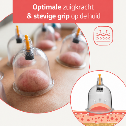 HABYS Cuppingset - 24 delig - met cuppingbekers - inclusief pomp